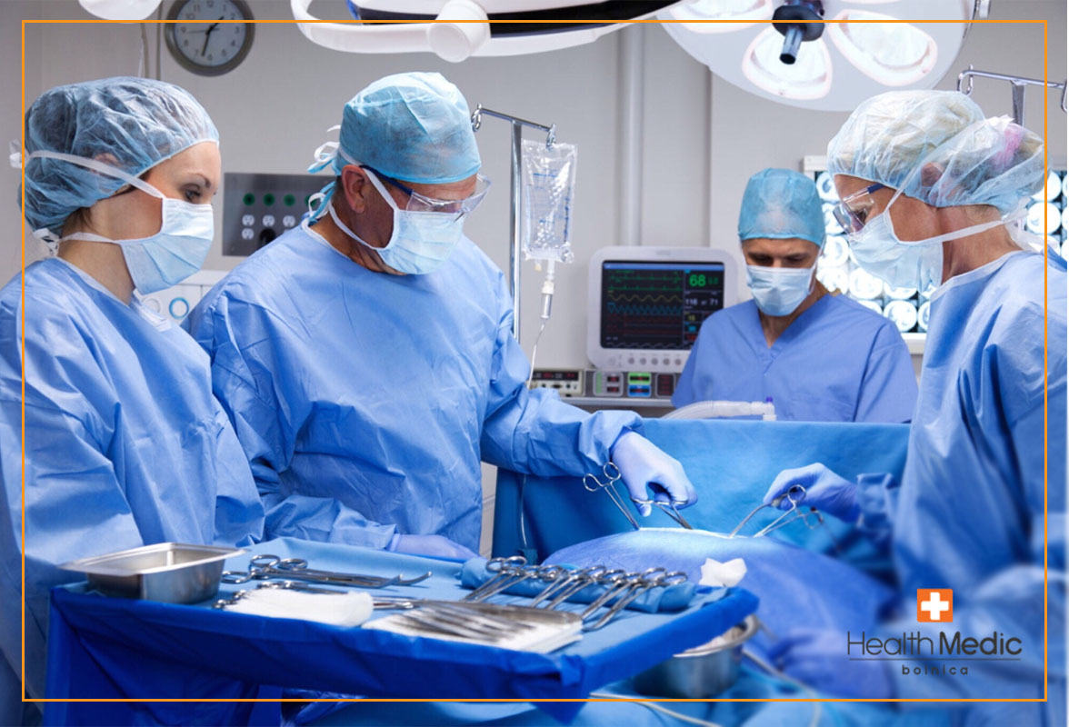 Holicistektomija – operacija žučne kese